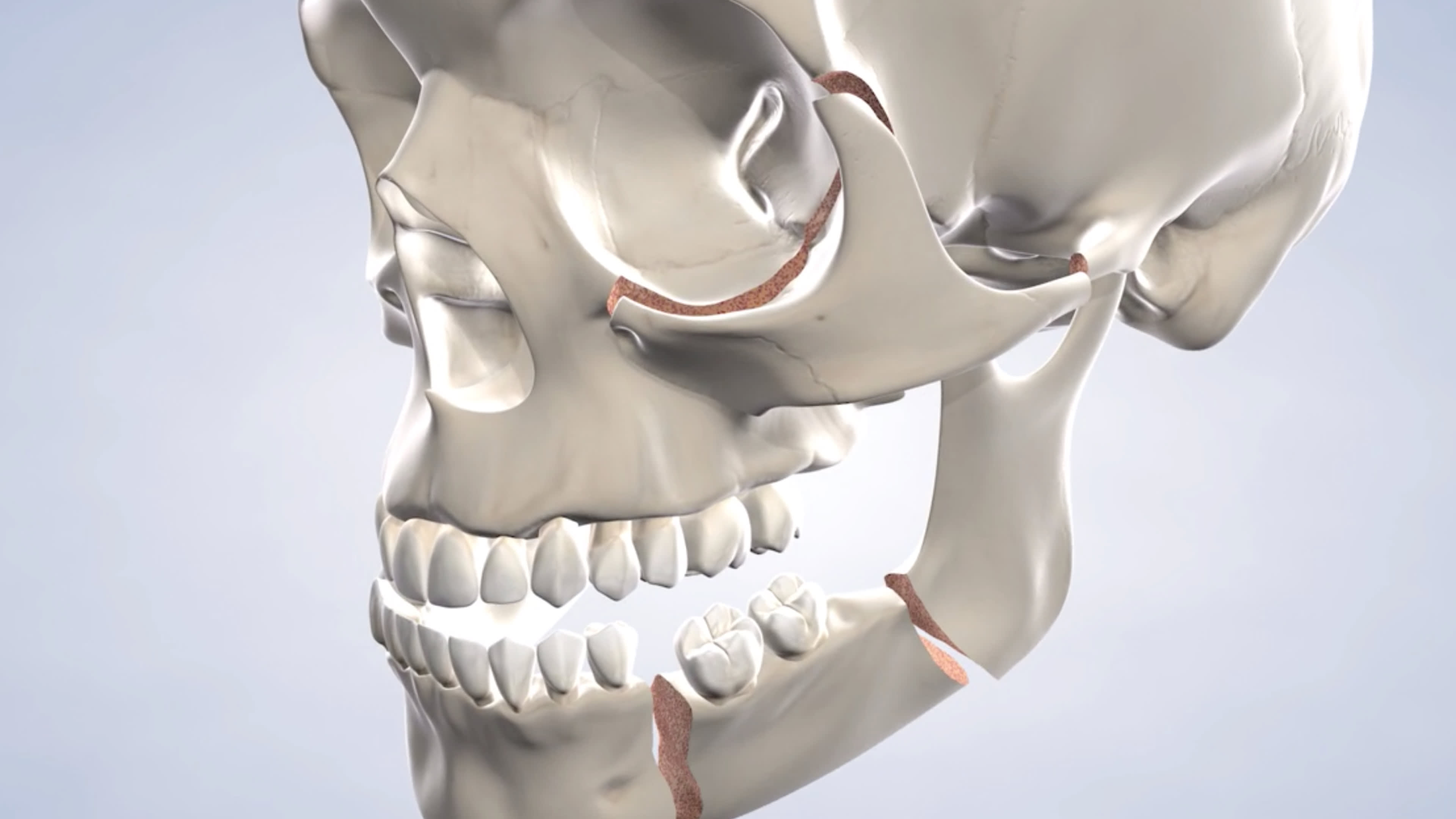 instruction  facial trauma