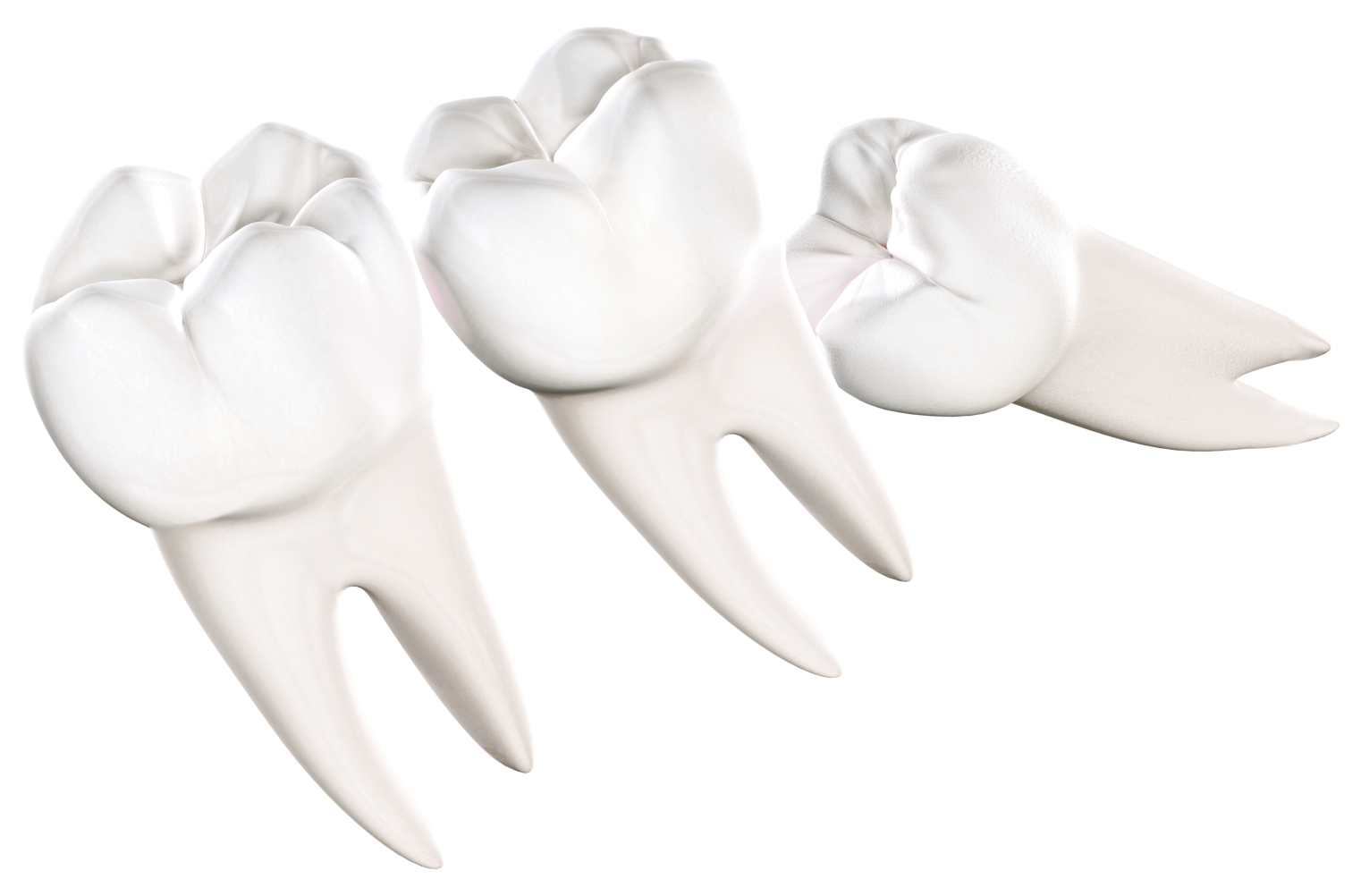 Isolated Wisdom Teeth